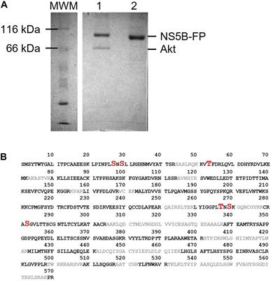 Akt Phosphorylation of Hepatitis C Virus NS5B Regulates Polymerase Activity and Hepatitis C Virus Infection